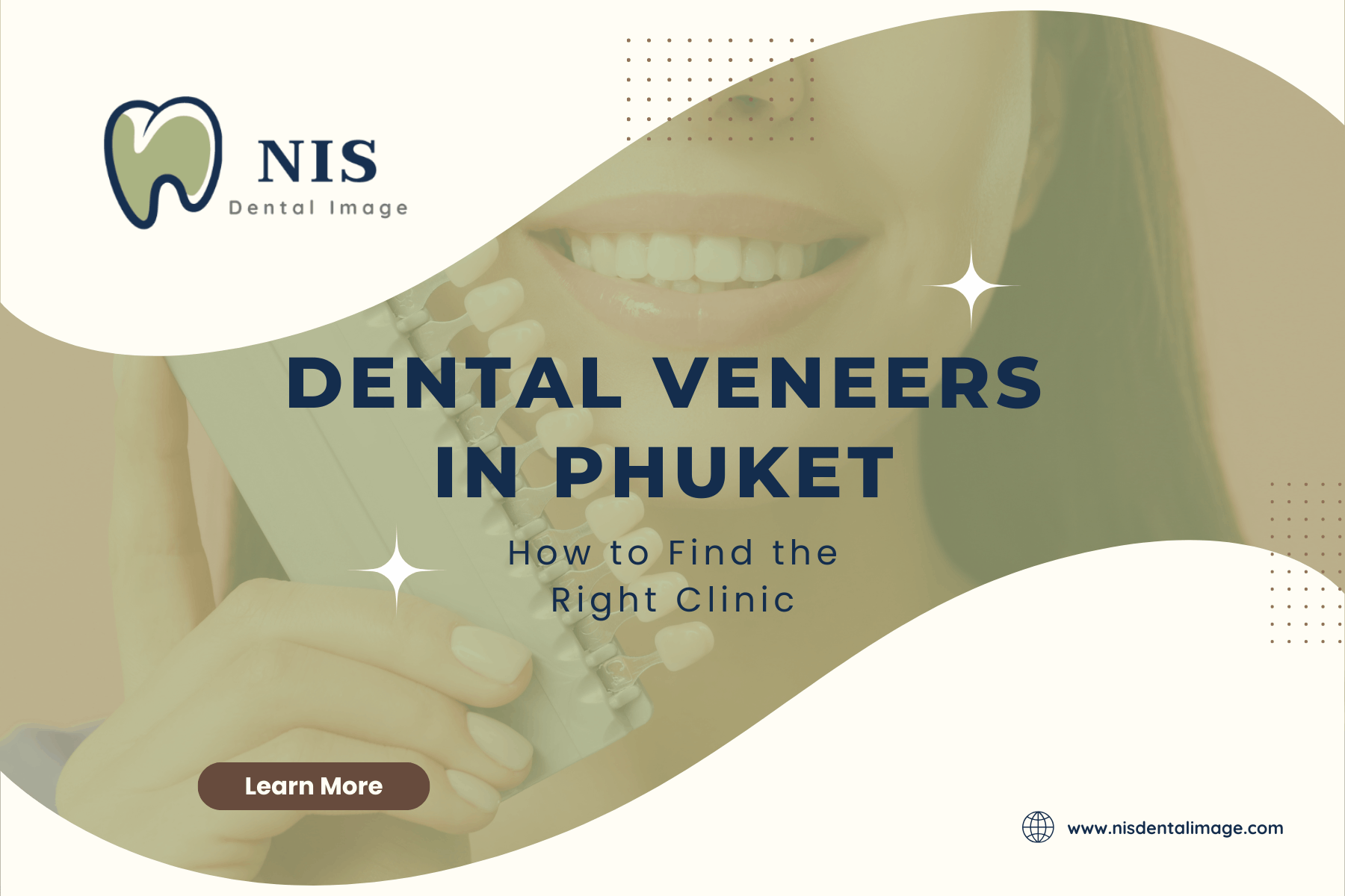 Dental Veneers in Phuket — How to Find the Right Clinic — NIS Dental Image, Patong Phuket