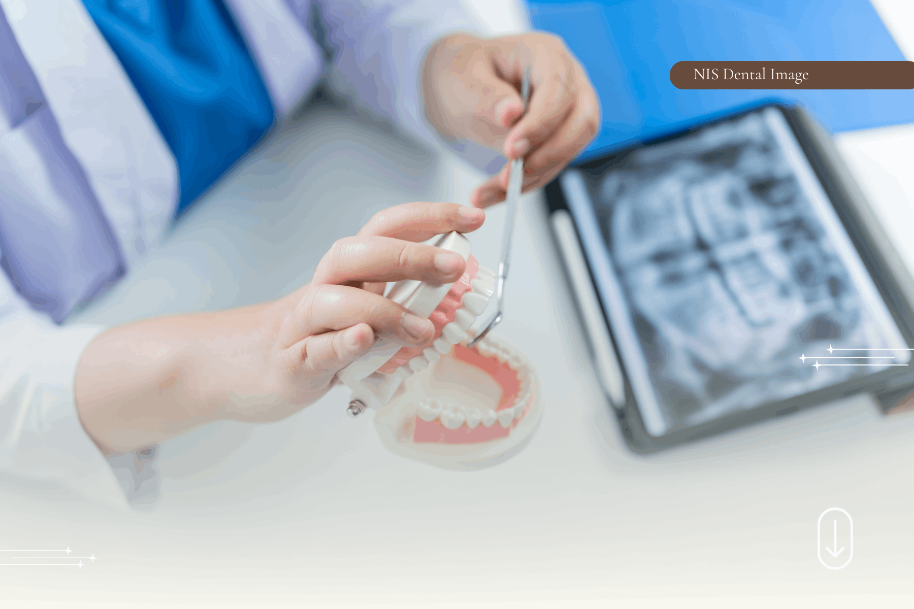 Dental Veneers in Phuket — How to Find the Right Clinic — case photo 1 at NIS Dental Image, Patong Phuket